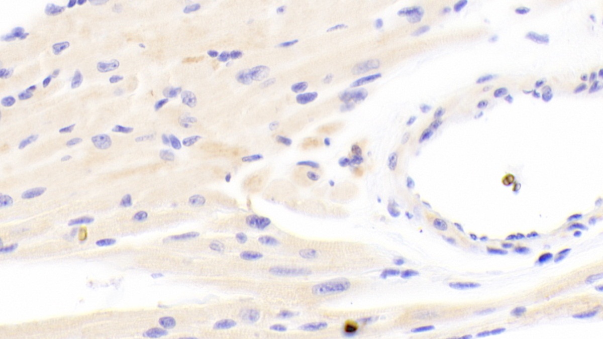 Polyclonal Antibody to Succinate Dehydrogenase Complex Subunit A (SDHA)