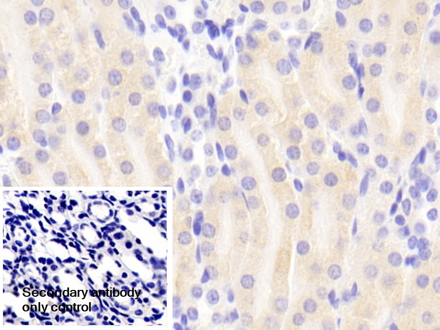 Polyclonal Antibody to Succinate Dehydrogenase Complex Subunit A (SDHA)