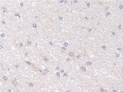 Polyclonal Antibody to NADH Dehydrogenase Ubiquinone Fe-S Protein 1 (NDUFS1)