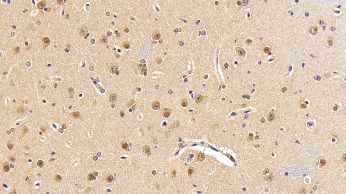 Polyclonal Antibody to Phosphoinositide-3-Kinase Catalytic Beta Polypeptide (PIK3Cb)