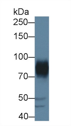 Polyclonal Antibody to A Disintegrin And Metalloprotease 22 (ADAM22)