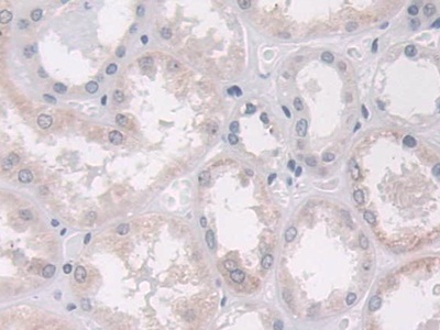 Polyclonal Antibody to A Disintegrin And Metalloproteinase With Thrombospondin 10 (ADAMTS10)