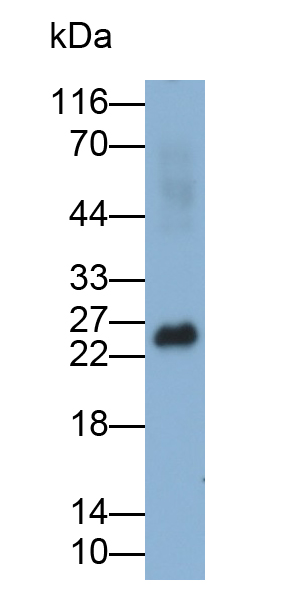 Polyclonal Antibody to Non Metastatic Cells 5, Protein NM23A Expressed In (NME5)