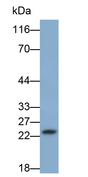 Polyclonal Antibody to RAB7A, Member RAS Oncogene Family (RAB7A)
