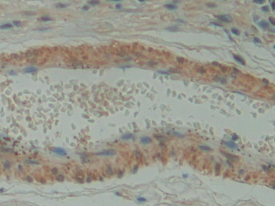 Polyclonal Antibody to Family With Sequence Similarity 3, Member D (FAM3D)
