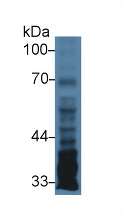 Polyclonal Antibody to Pentraxin 3, Long (PTX3)