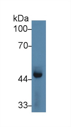 Polyclonal Antibody to Pentraxin 3, Long (PTX3)