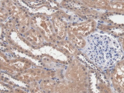 Polyclonal Antibody to Dicer 1, Ribonuclease Type III (DICER1)