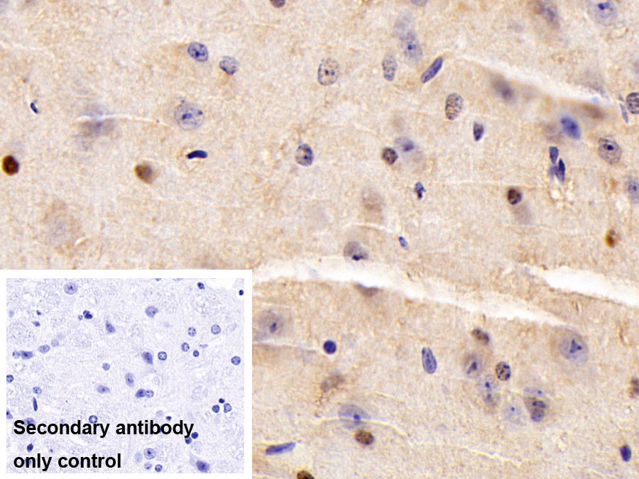 Polyclonal Antibody to Eomesodermin (EOMES)