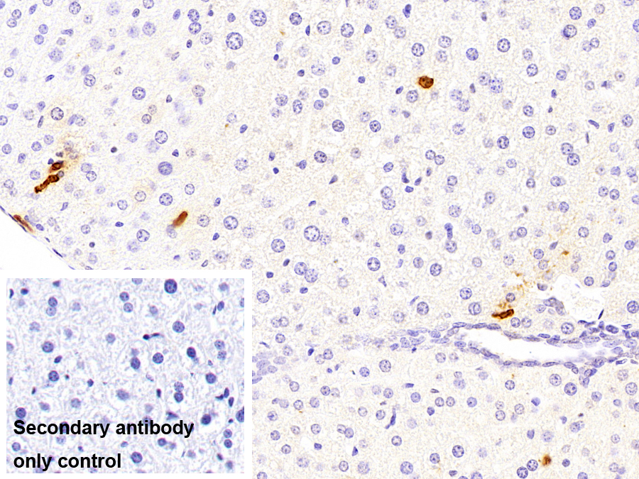 Polyclonal Antibody to Calprotectin (CALPRO)