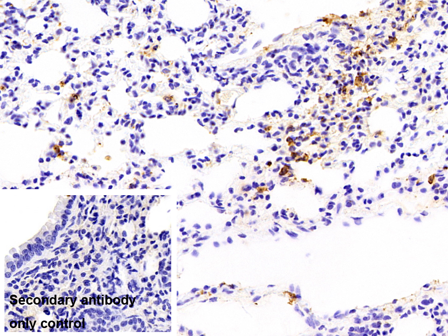 Polyclonal Antibody to Calprotectin (CALPRO)