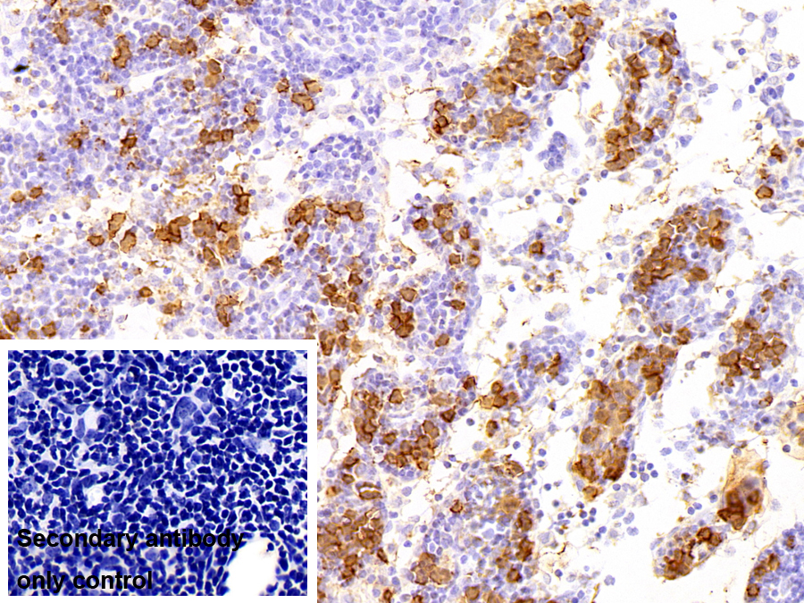 Polyclonal Antibody to Calprotectin (CALPRO)
