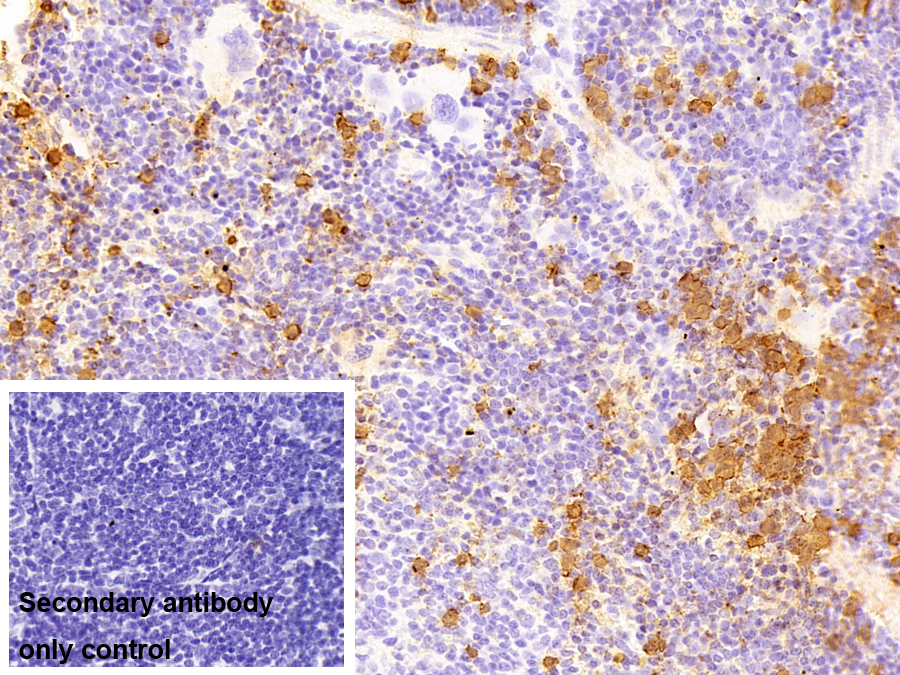 Polyclonal Antibody to Calprotectin (CALPRO)