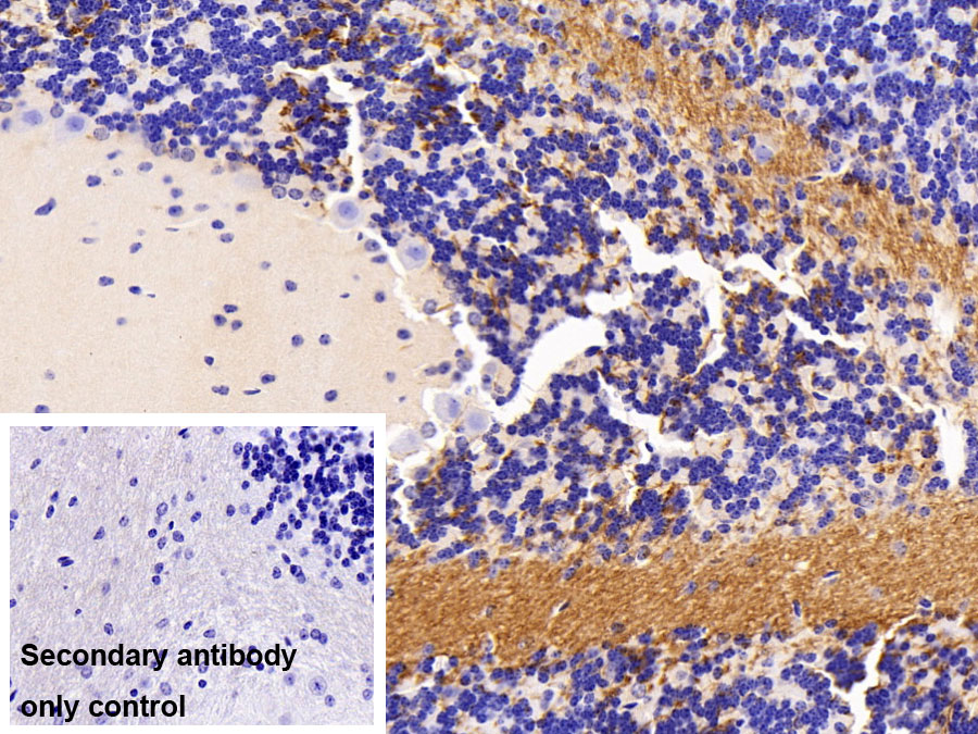 Polyclonal Antibody to Potassium Intermediate Small Conductance Calcium Activated Channel Subfamily N, Member 2 (KCNN2)