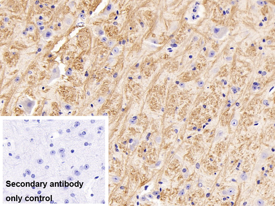 Polyclonal Antibody to Potassium Intermediate Small Conductance Calcium Activated Channel Subfamily N, Member 2 (KCNN2)