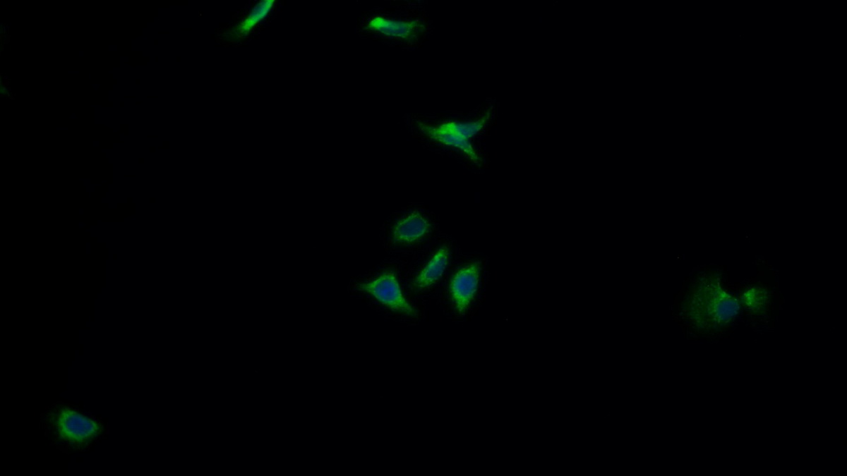 Polyclonal Antibody to PTEN Induced Putative Kinase 1 (PINK1)