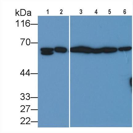Polyclonal Antibody to PTEN Induced Putative Kinase 1 (PINK1)