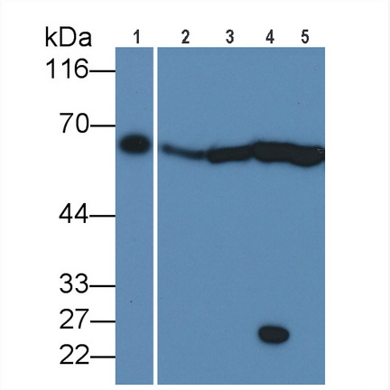 Polyclonal Antibody to PTEN Induced Putative Kinase 1 (PINK1)