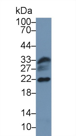 Polyclonal Antibody to Parkinson Disease Protein 7 (PARK7)