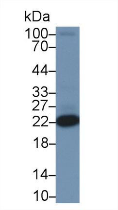 Polyclonal Antibody to Parkinson Disease Protein 7 (PARK7)