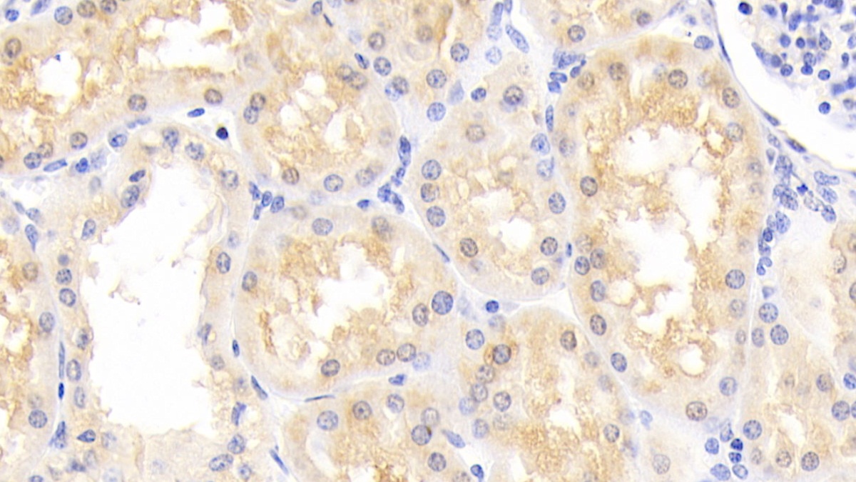 Polyclonal Antibody to Parkinson Disease Protein 7 (PARK7)