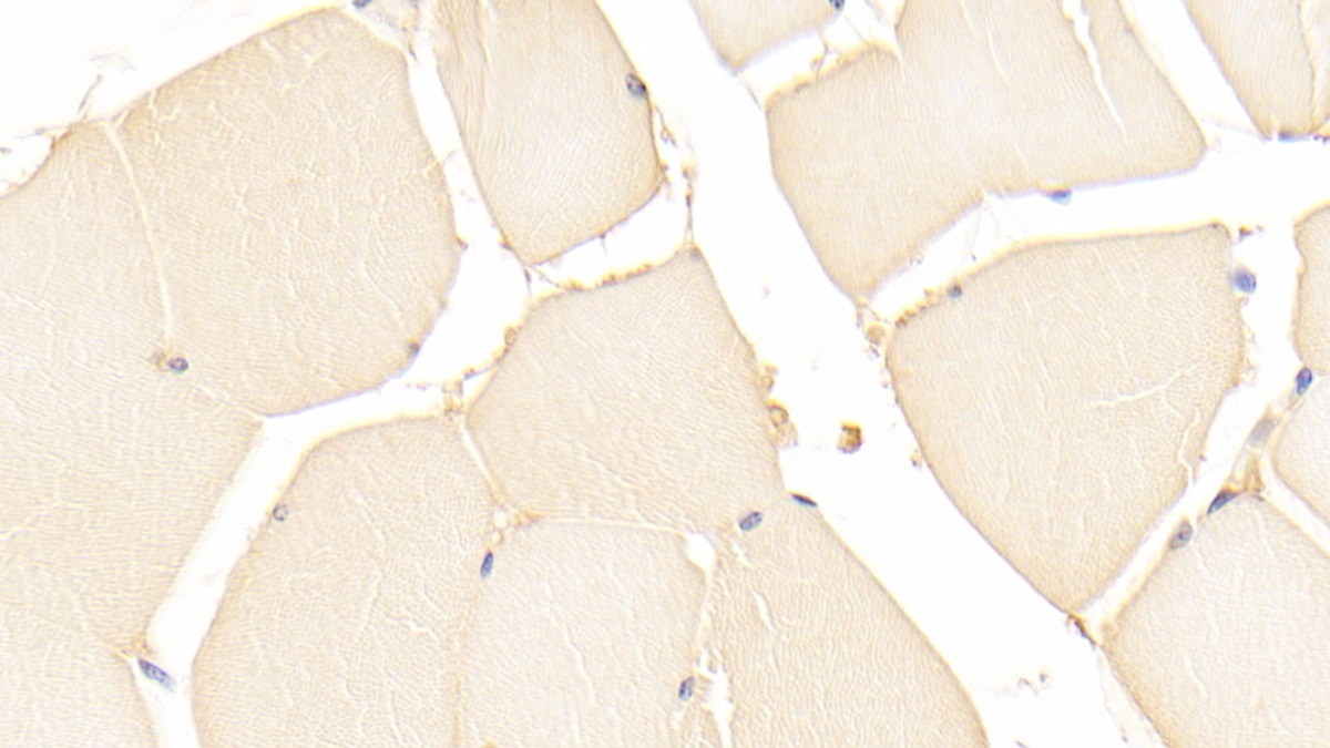Polyclonal Antibody to Parkinson Disease Protein 7 (PARK7)