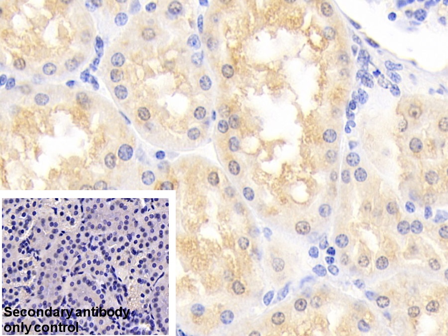 Polyclonal Antibody to Parkinson Disease Protein 7 (PARK7)