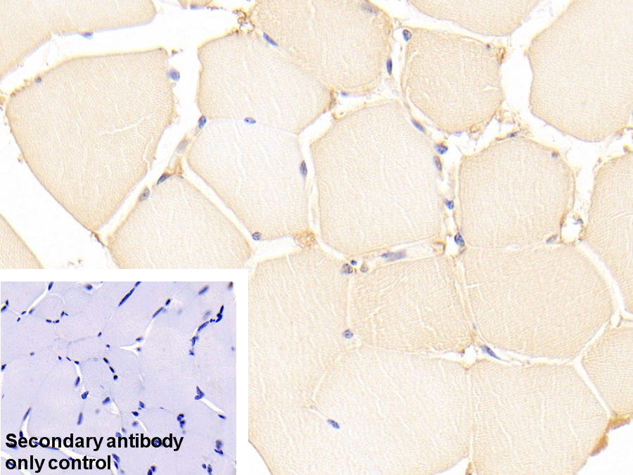 Polyclonal Antibody to Parkinson Disease Protein 7 (PARK7)