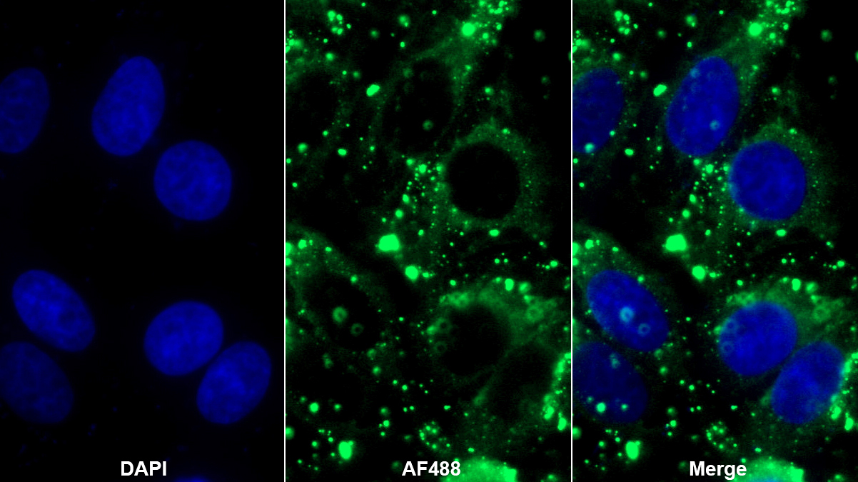 Polyclonal Antibody to Parkinson Disease Protein 7 (PARK7)