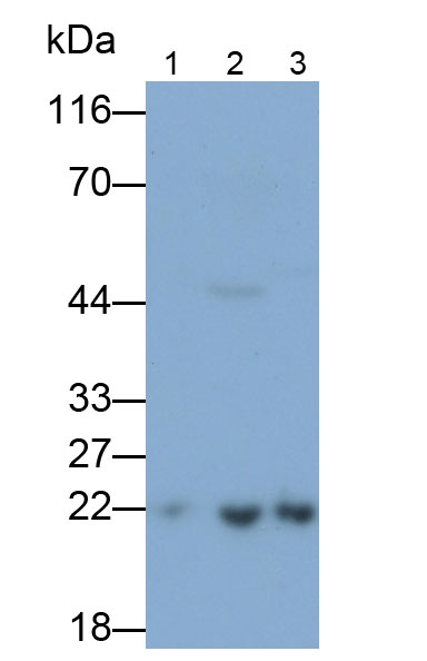 Polyclonal Antibody to Parkinson Disease Protein 7 (PARK7)