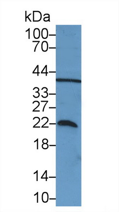 Polyclonal Antibody to Parkinson Disease Protein 7 (PARK7)