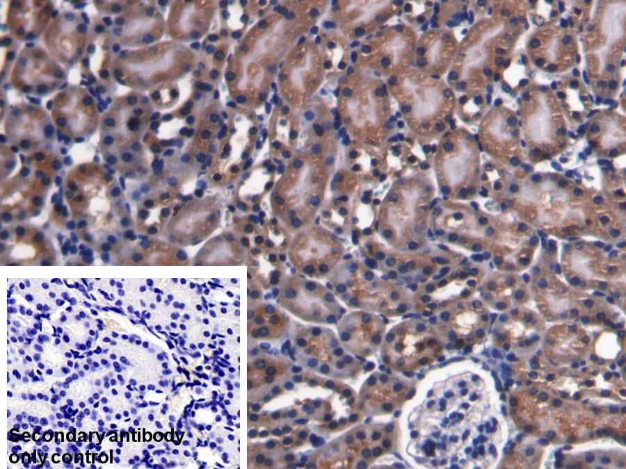 Polyclonal Antibody to Parkinson Disease Protein 7 (PARK7)