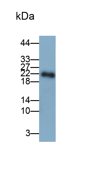 Polyclonal Antibody to Parkinson Disease Protein 7 (PARK7)