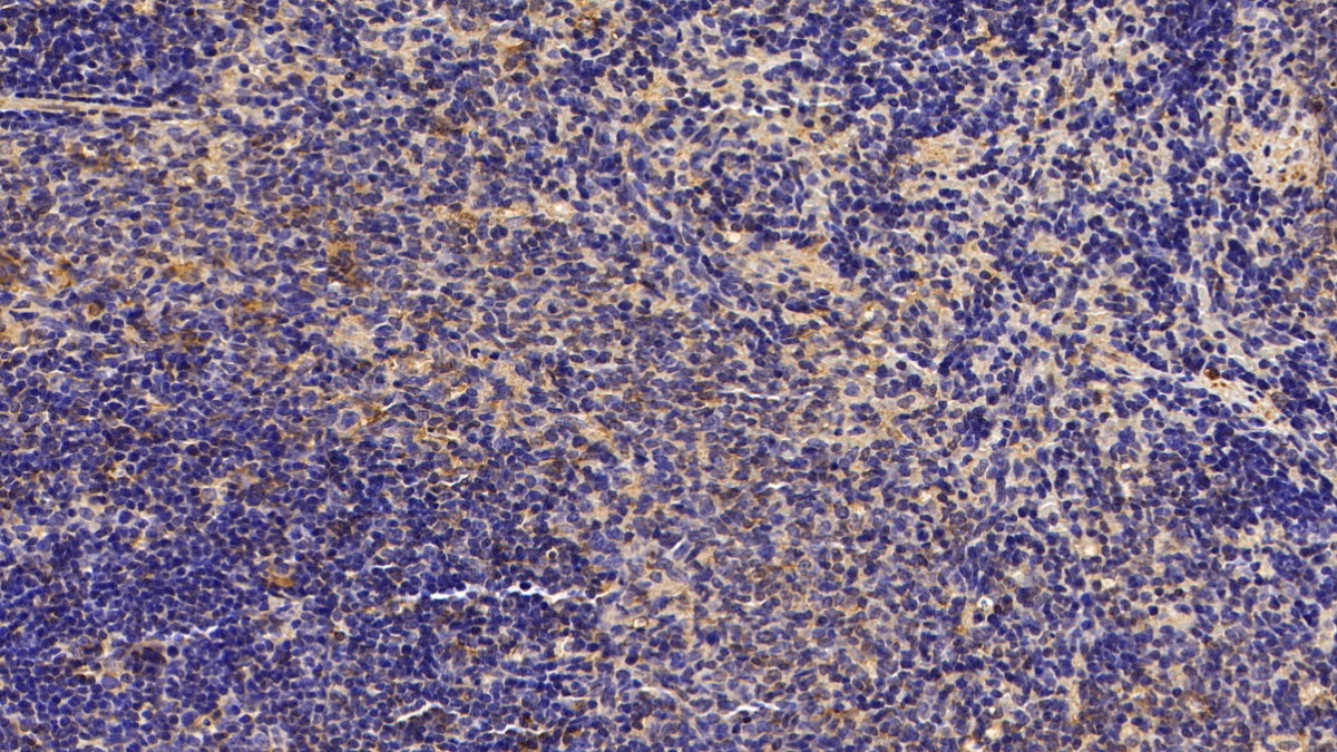 Polyclonal Antibody to Parkinson Disease Protein 7 (PARK7)