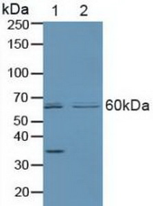 Polyclonal Antibody to Parkinson Disease Protein 2 (PARK2)