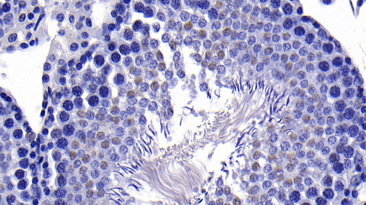 Polyclonal Antibody to Parkinson Disease Protein 2 (PARK2)