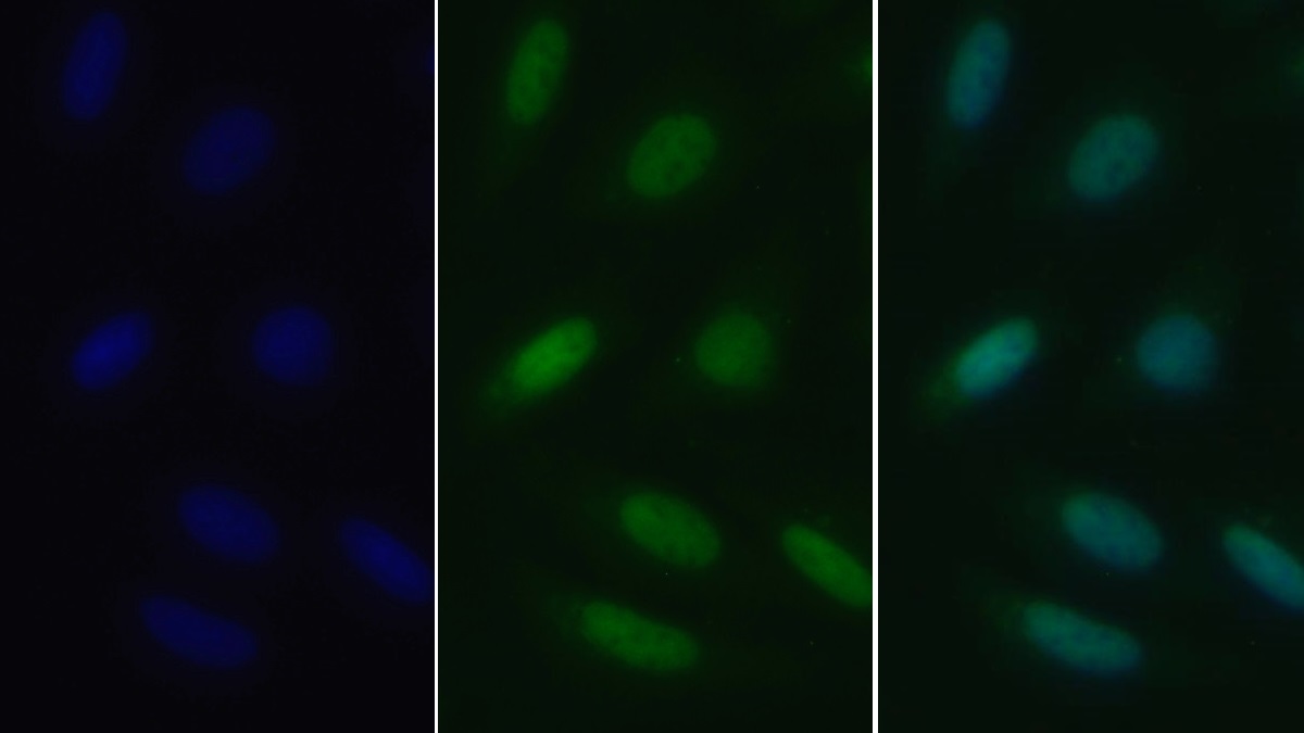 Polyclonal Antibody to Parkinson Disease Protein 2 (PARK2)