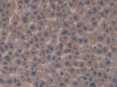 Polyclonal Antibody to Fibroblast Growth Factor Receptor Like Protein 1 (FGFRL1)