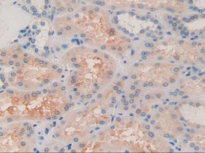 Polyclonal Antibody to Alpha-2-Glycoprotein 1, Zinc Binding (aZGP1)