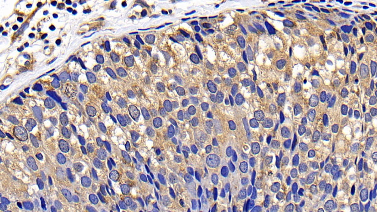 Polyclonal Antibody to B-Cell CLL/Lymphoma 2 Like Protein 2 (Bcl2L2)