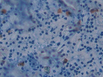 Polyclonal Antibody to Brother Of CDO Homolog (BOC)