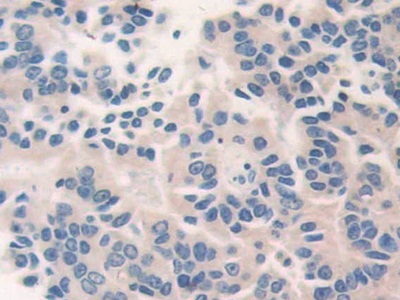 Polyclonal Antibody to Cat Eye Syndrome Chromosome Region, Candidate 1 (CECR1)