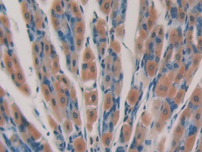 Polyclonal Antibody to DNA Fragmentation Factor Subunit Alpha (DFFa)