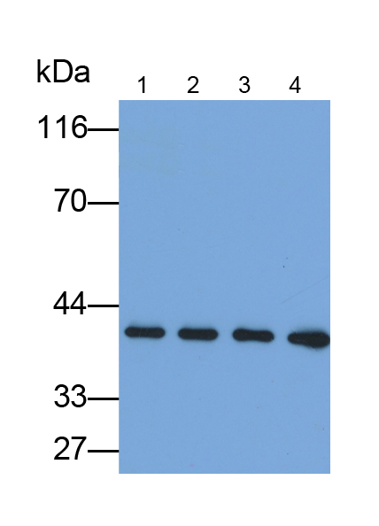 Polyclonal Antibody to Deoxyribonuclease I Like Protein 3 (DNASE1L3)