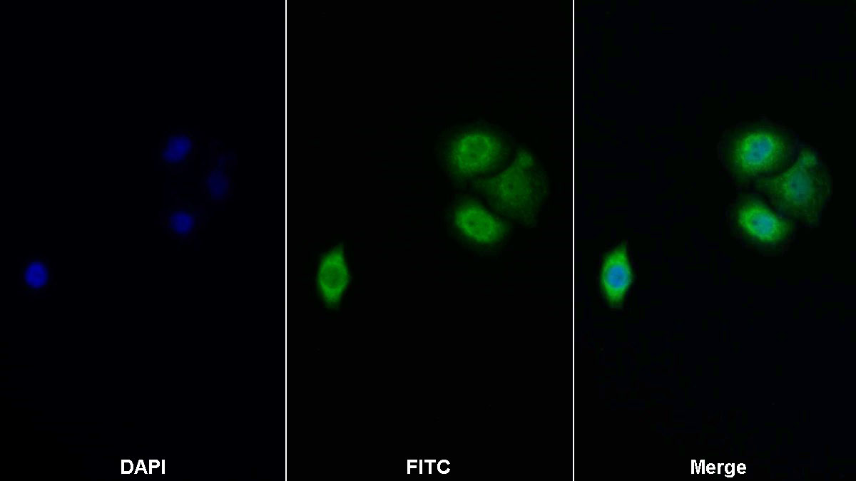 Polyclonal Antibody to Eukaryotic Translation Initiation Factor 4E Binding Protein 1 (EIF4EBP1)