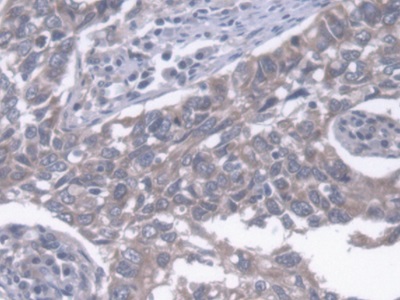 Polyclonal Antibody to Endoplasmic Reticulum Lipid Raft Associated Protein 2 (ERLIN2)