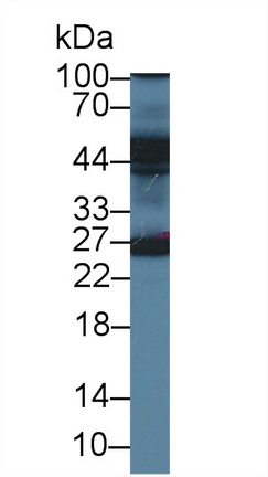 Polyclonal Antibody to Endoplasmic Reticulum Lipid Raft Associated Protein 2 (ERLIN2)