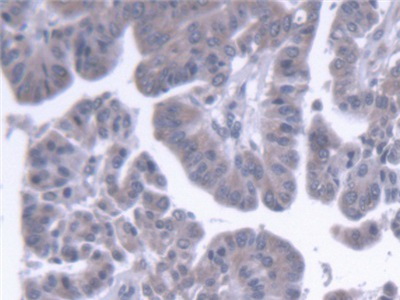 Polyclonal Antibody to Endoplasmic Reticulum Lipid Raft Associated Protein 2 (ERLIN2)