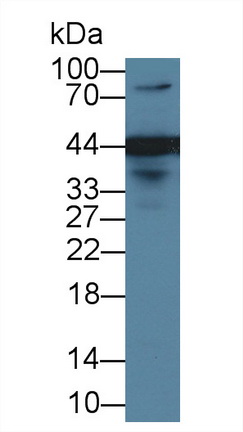 Polyclonal Antibody to Endoplasmic Reticulum Lipid Raft Associated Protein 2 (ERLIN2)