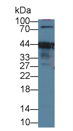 Polyclonal Antibody to Endoplasmic Reticulum Lipid Raft Associated Protein 2 (ERLIN2)